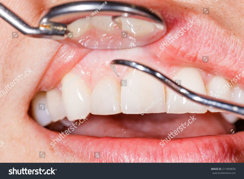 stockphotoperiodicdentalexaminationtohaveahealthymouthand